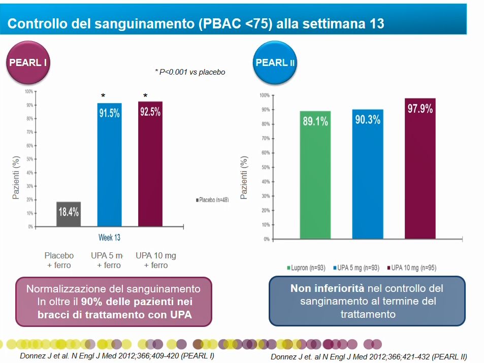 Ulipristal acetato nella fibromatosi
